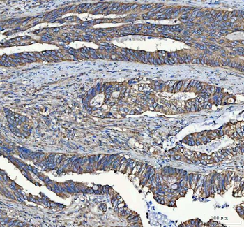 Anti-C19orf10/MYDGF Antibody