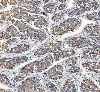 Anti-C19orf10/MYDGF Antibody