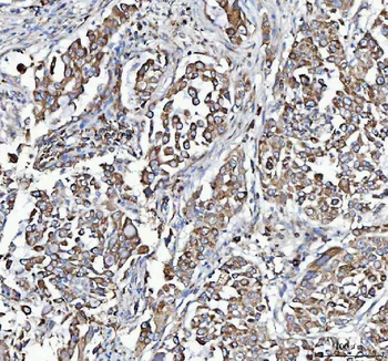 Anti-C19orf10/MYDGF Antibody