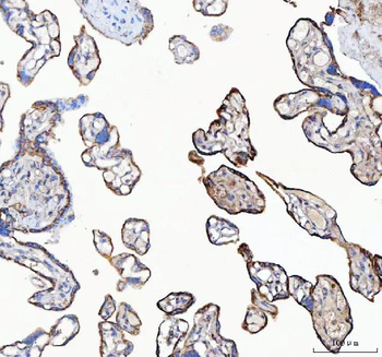 Anti-C19orf10/MYDGF Antibody