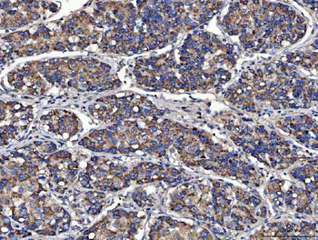 Anti-MOCS2 Antibody