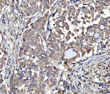 Anti-MOCS2 Antibody