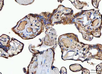 Anti-MOCS2 Antibody