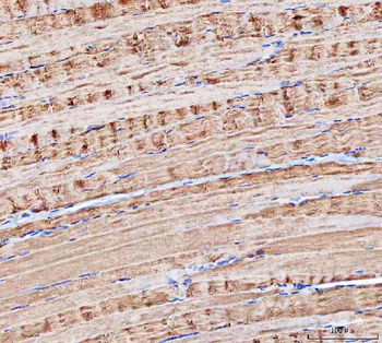 Anti-MOCS2 Antibody