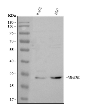 Anti-MMACHC Antibody