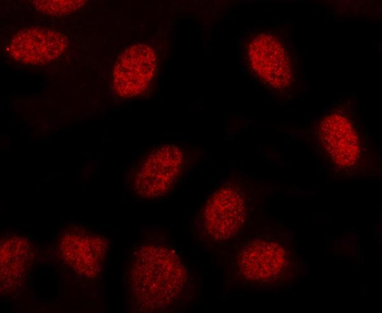 Anti-MINDY3 Antibody