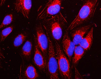 Anti-NAP1L1 Antibody