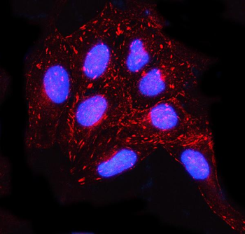 Anti-MISP Antibody