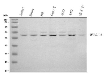 Anti-MFSD13A Antibody