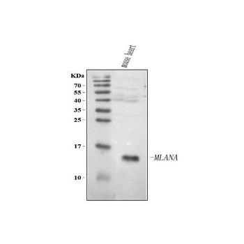 Melan-A/MLANA Antibody