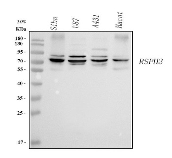 Anti-RSPH3 Antibody