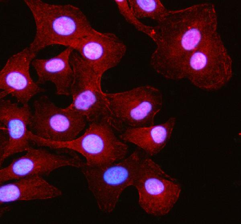 Anti-RSPH3 Antibody