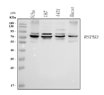 Anti-RSPH3 Antibody