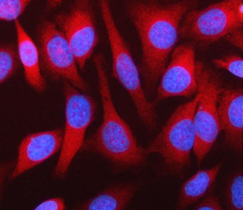 Anti-MPHOSPH9 Antibody