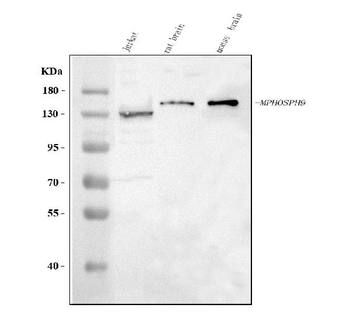 Anti-MPHOSPH9 Antibody