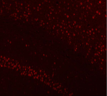 Anti-NUCKS1 Antibody