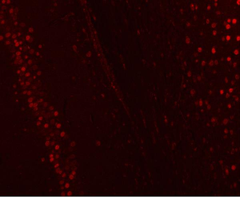 Anti-NUCKS1 Antibody