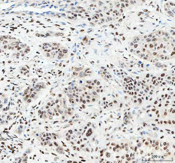 Anti-NUCKS1 Antibody