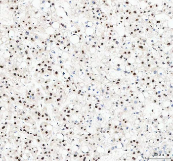Anti-NUCKS1 Antibody
