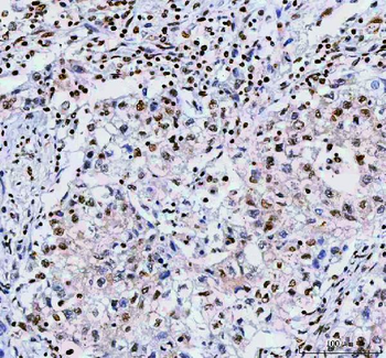 Anti-NUCKS1 Antibody