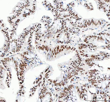Anti-NUCKS1 Antibody