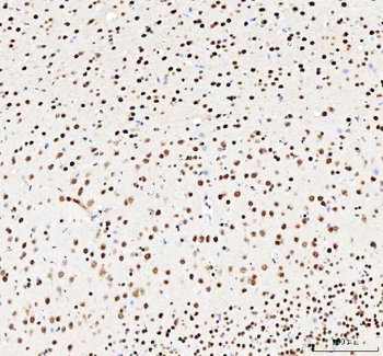 Anti-NUCKS1 Antibody