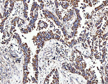 Anti-MOCS1 Antibody