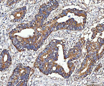 Anti-MOCS1 Antibody