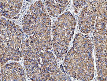 Anti-MOCS1 Antibody