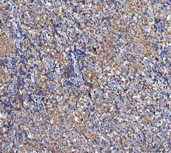 Anti-MOCS1 Antibody