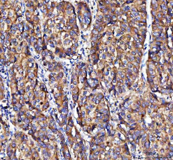 Anti-MOAP1 Antibody