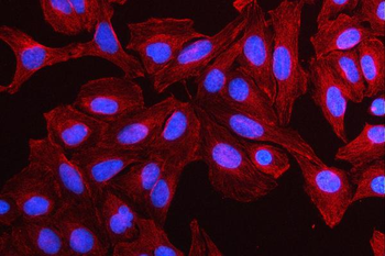 Anti-MMP19 Antibody