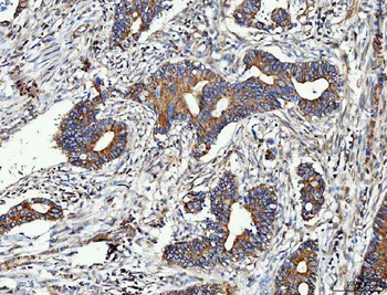 Anti-MMP19 Antibody