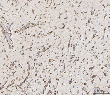 Anti-MMP19 Antibody