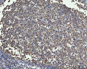 Anti-MMP19 Antibody