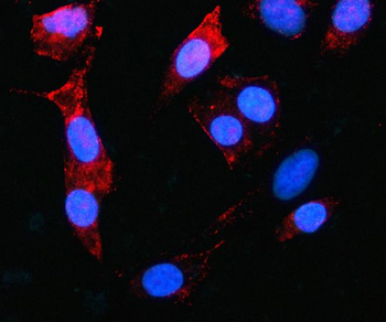 Anti-MAGED4 Antibody