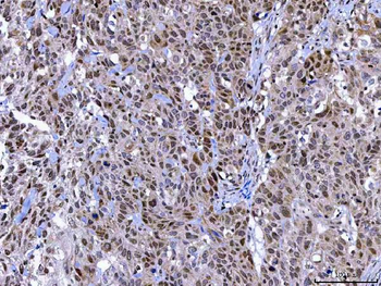 Anti-MAGED4 Antibody