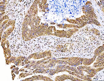 Anti-MAGED4 Antibody