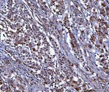 Anti-NUDCD1 Antibody