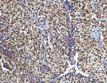 Anti-NUDCD1 Antibody