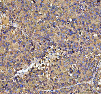 Anti-NUBPL Antibody