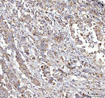 Anti-NUBPL Antibody
