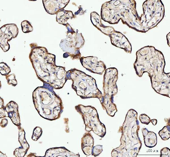 Anti-NUBPL Antibody