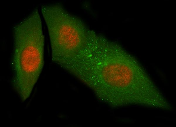 Anti-NUB1 Antibody