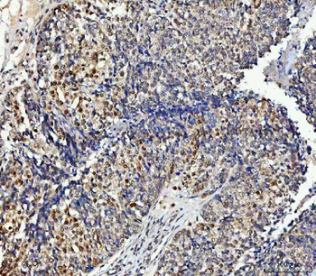 Anti-NUB1 Antibody