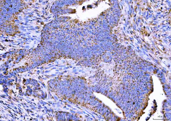 Anti-NTN3 Antibody