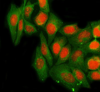 Anti-NTHL1 Antibody