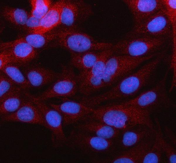MARCHF2 Rabbit Polyclonal Antibody