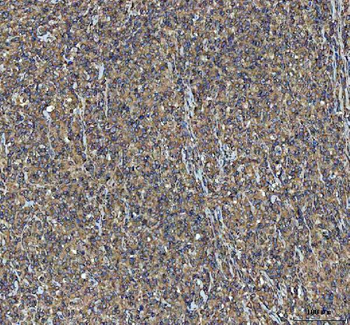 Anti-NSG1 Antibody