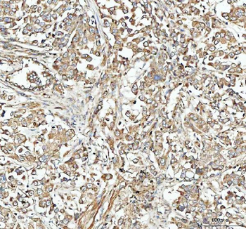 Anti-NSG1 Antibody